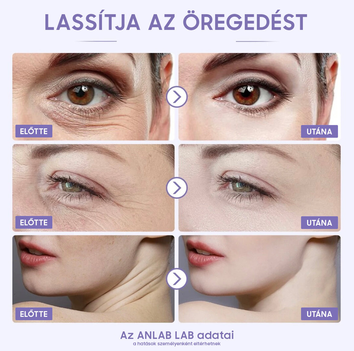 ANLAN PEARL Arcápoló kozmetikai gép