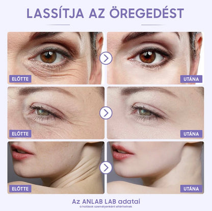 ANLAN PEARL Arcápoló kozmetikai gép